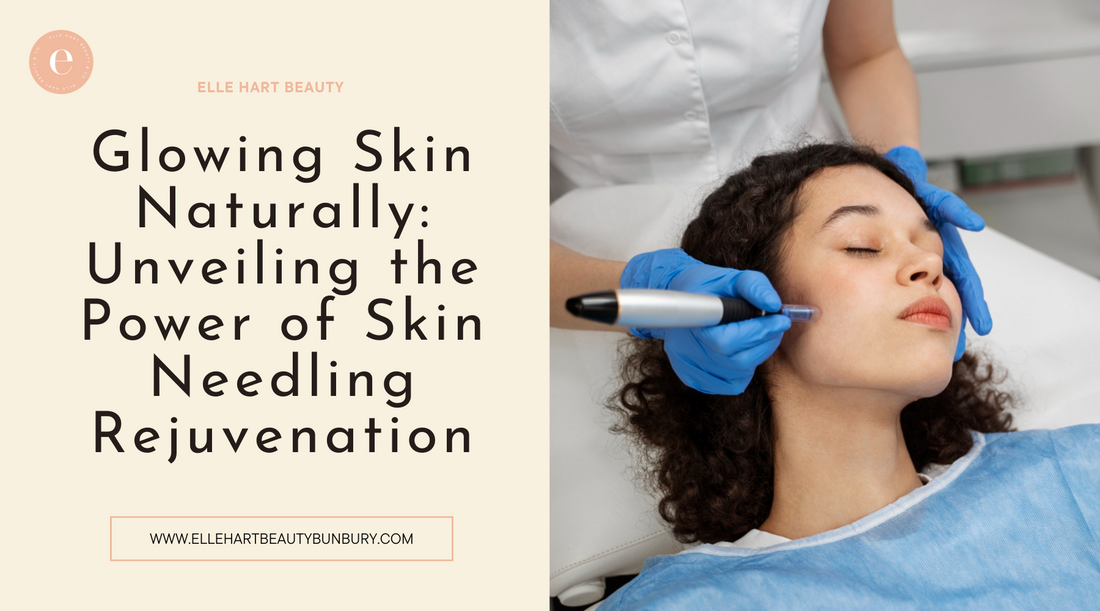 Glowing Skin Naturally: Unveiling the Power of Skin Needling Rejuvenation